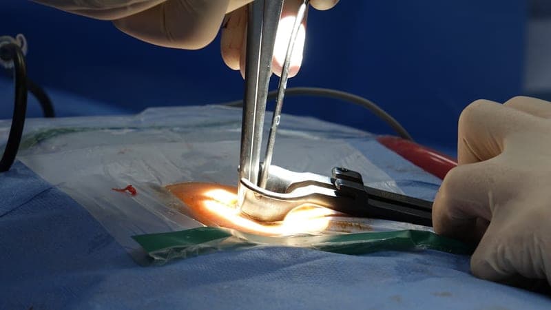 Minimally Invasive Spine Surgery